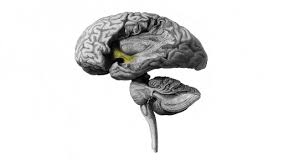 Cerebral